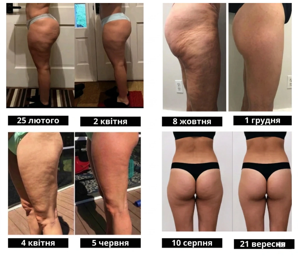 Фото результатів до та після в легінсах Shape Boost 3D